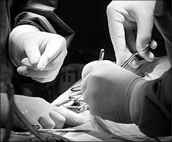 Пересадка почек по-киргизски: ни врачей, ни оборудования, ни денег. А две операции сделали